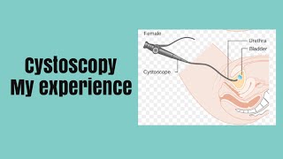 Cystoscopy experience NHS wales [upl. by Ert]