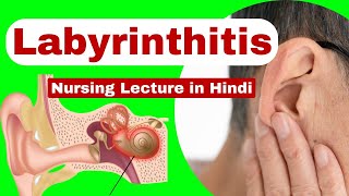 Labyrinthitis  causes symptoms management  medical surgical nursing  nursing lecture in hindi [upl. by Ulrike]