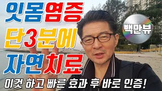 잇몸염증 자연치료치은염 치주염 단3분👌즉시 효과간단하게 잇몸치료😃이빨이 치주염으로 아플때 잇몸고름 치통 순삭 경험하고 바로 간단한 자연치료 건강꿀팁 공유👍👍👍 [upl. by Animahs]