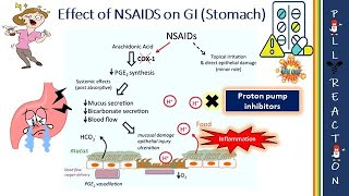 NSAIDs and Peptic Ulcer  Side effects  Gastric Bleeding  Kidney Injury [upl. by Enileuqaj555]