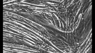 C2C12 muscle fiber contraction [upl. by Terces]