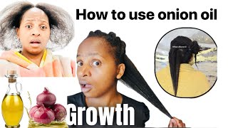 How to use Onion oil for hair growth amp thickness Use onion oil this way [upl. by Ybbed]