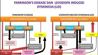 Video 52 Parkinsons Disease dan Levodopa Induced Dyskinesia LID [upl. by Hoskinson324]