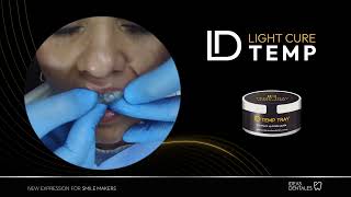 Provisionales para carillas con ID Light Cure System [upl. by Edmea]