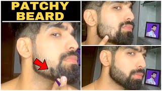 Patchy beard Hacks🖊 shorts patchybeard [upl. by Ellehcem]