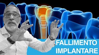 Fallimento dellimpianto dentale da cosa dipende [upl. by Burkhard]