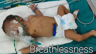 Breathing problem in Newborn babyBreathlessness amp Grunting newborn [upl. by Alekim]