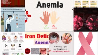 Iron Deficiency AnaemiaNew causesSymptoms treatment and more [upl. by Lihkin]