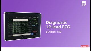 Capture a diagnostic 12lead ECG with the IntelliVue patient monitor [upl. by Nagirrek98]