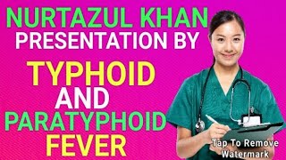 TYPHOID amp PARATYPHOID FEVER PRESENTATION BY NURTAZUL KHAN [upl. by Martino585]