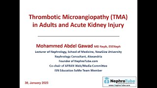 Thrombotic Microangiopathy TMA in Adults and Acute Kidney Injury  English Language  Dr Gawad [upl. by Elletnohs491]