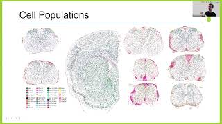 Cellular architecture of evolving neuroinflammatory lesions and multiple sclerosis pathology [upl. by Sulokcin]