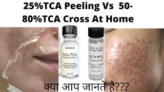 25TCA peeling Vs 80 TCA Cross At Home अपने स्कार्स को पहचाने फिर चुने TCA cross and TCA peel [upl. by Vinnie]