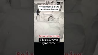 This is Dravet syndrome epilepsy seizure neurology neuro medtok medical doctor [upl. by Eetak]