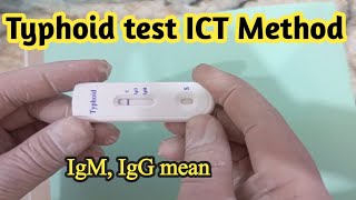 Typhoid Test in Laboratory UrduHindiIgM amp IgG mean [upl. by Avlasor]