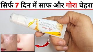 Melacare Cream Review in Hindi मेलाकेयर क्रीम के फायदे नुकसान उपयोग [upl. by Bandeen]