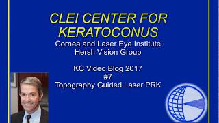 CLEI Center For Keratoconus  TopographyGuided PRK for Keratoconus  Episode 7 [upl. by Hanafee]