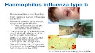 Poliomyelitis  Symptoms and Prevention [upl. by Aydin]