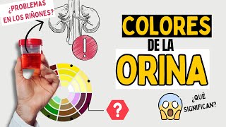 ¿Cómo Interpretar el Color de la Orina Descubre su SIGNIFICADO [upl. by Nnylekoorb]