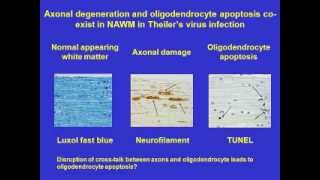 Multiple sclerosis axonal damage part 3 axonal damage and inflammationwmv [upl. by Lindsley239]