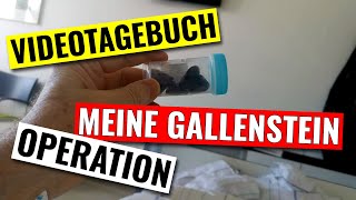 Videotagebuch zur Operation meiner Gallensteine [upl. by Nwad]